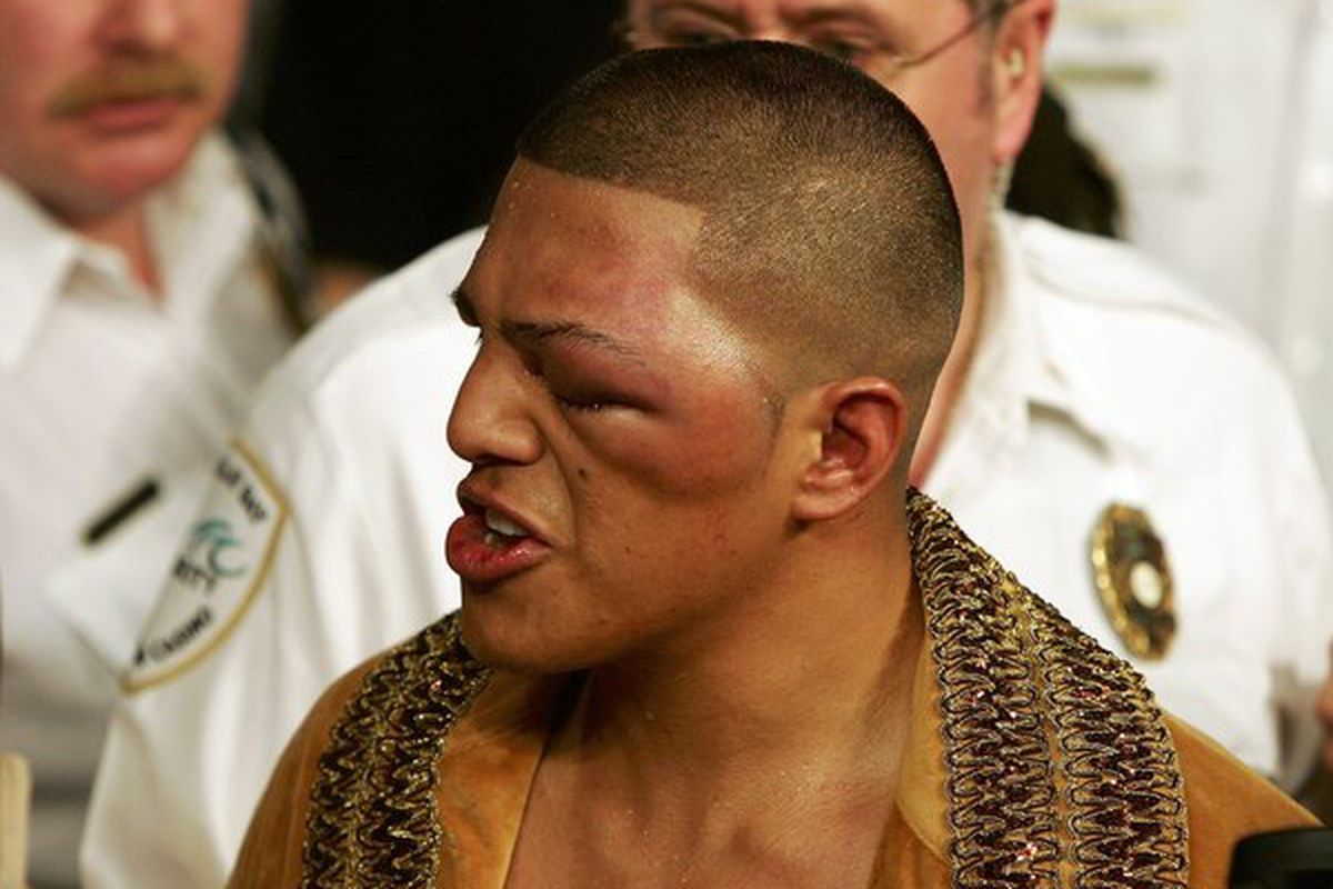 Pictures of Fernando Vargas